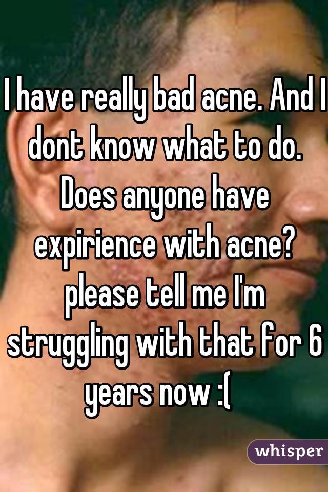 I have really bad acne. And I dont know what to do. Does anyone have expirience with acne? please tell me I'm struggling with that for 6 years now :(  