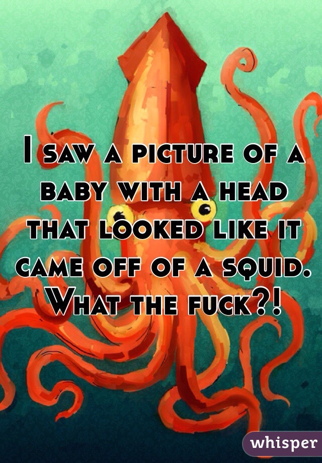 I saw a picture of a baby with a head that looked like it came off of a squid. What the fuck?!