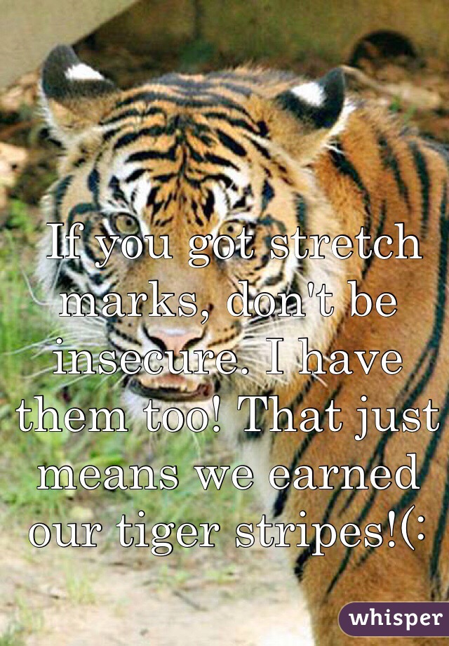  If you got stretch marks, don't be insecure. I have them too! That just means we earned our tiger stripes!(: