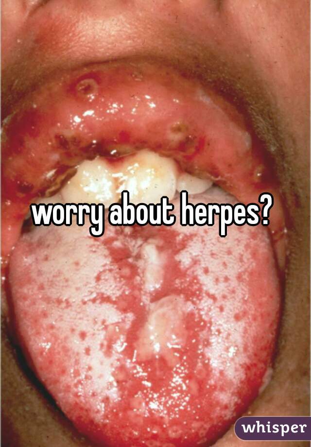 worry about herpes? 