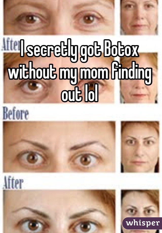I secretly got Botox without my mom finding out lol