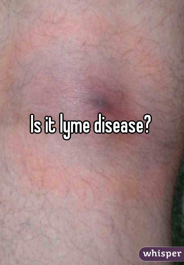 Is it lyme disease?