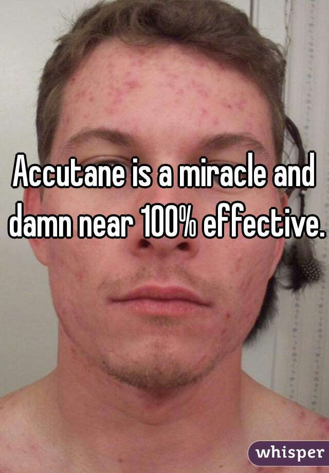 Accutane is a miracle and damn near 100% effective.  