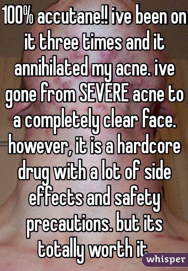 100% accutane!! ive been on it three times and it annihilated my acne. ive gone from SEVERE acne to a completely clear face. however, it is a hardcore drug with a lot of side effects and safety precautions. but its totally worth it. 