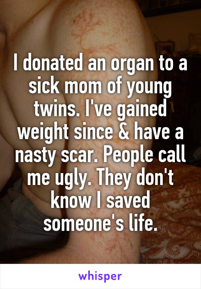 I donated an organ to a sick mom of young twins. I've gained weight since & have a nasty scar. People call me ugly. They don't know I saved someone's life.