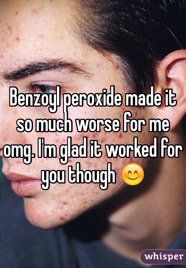 Benzoyl peroxide made it so much worse for me omg. I'm glad it worked for you though 😊