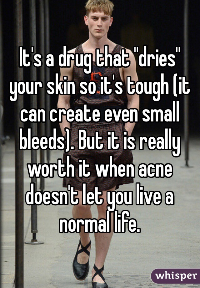 It's a drug that "dries" your skin so it's tough (it can create even small bleeds). But it is really worth it when acne doesn't let you live a normal life. 