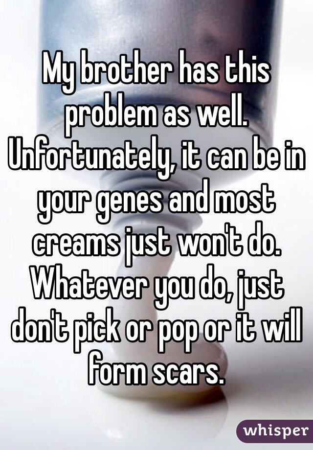 My brother has this problem as well. Unfortunately, it can be in your genes and most creams just won't do. Whatever you do, just don't pick or pop or it will form scars.