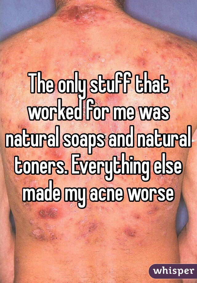 The only stuff that worked for me was natural soaps and natural toners. Everything else made my acne worse