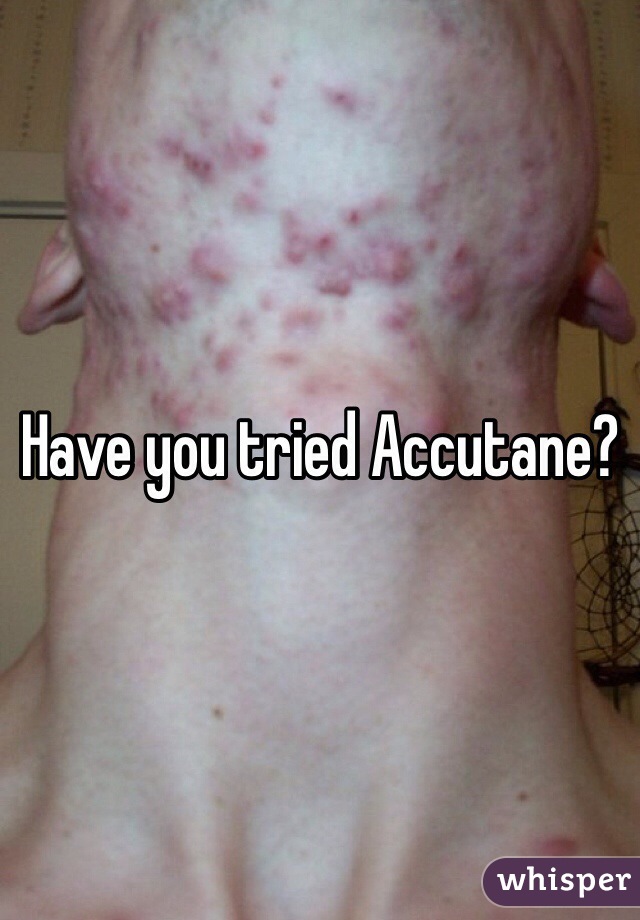 Have you tried Accutane?