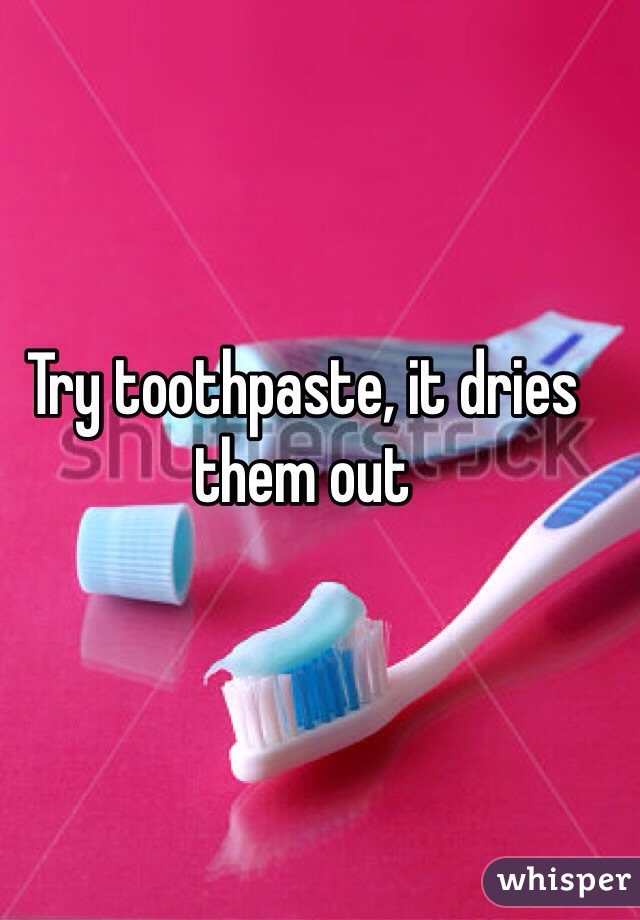 Try toothpaste, it dries them out 