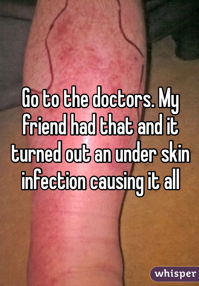 Go to the doctors. My friend had that and it turned out an under skin infection causing it all