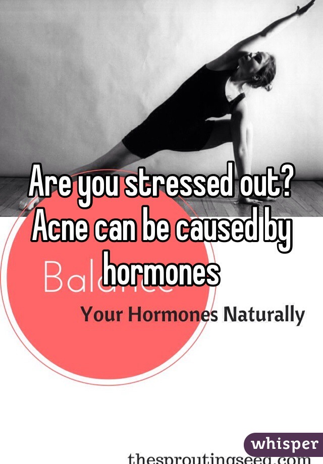 Are you stressed out? 
Acne can be caused by hormones 