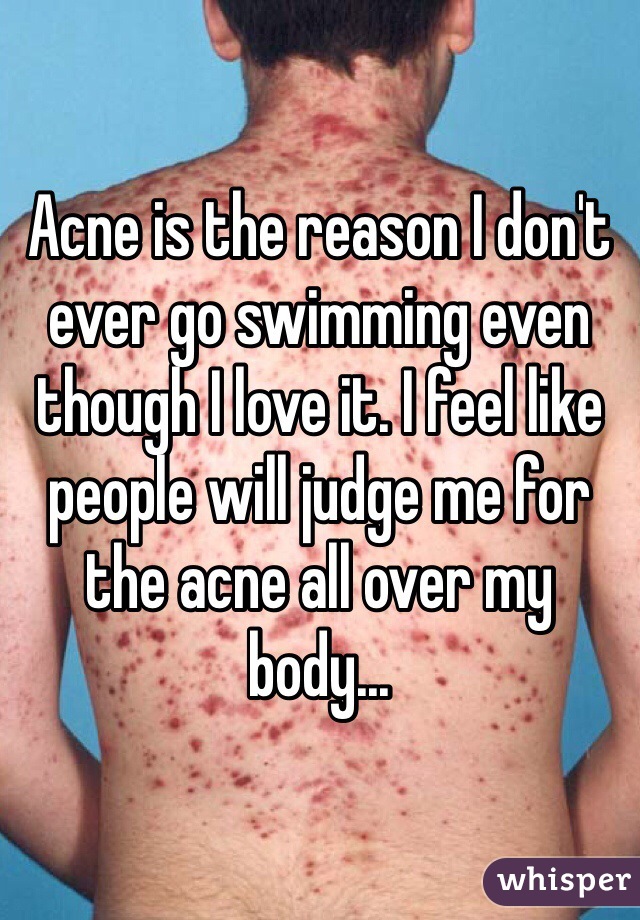 Acne is the reason I don't ever go swimming even though I love it. I feel like people will judge me for the acne all over my body...