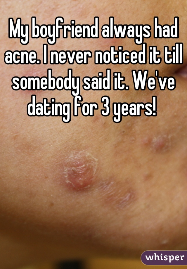 My boyfriend always had acne. I never noticed it till somebody said it. We've dating for 3 years! 