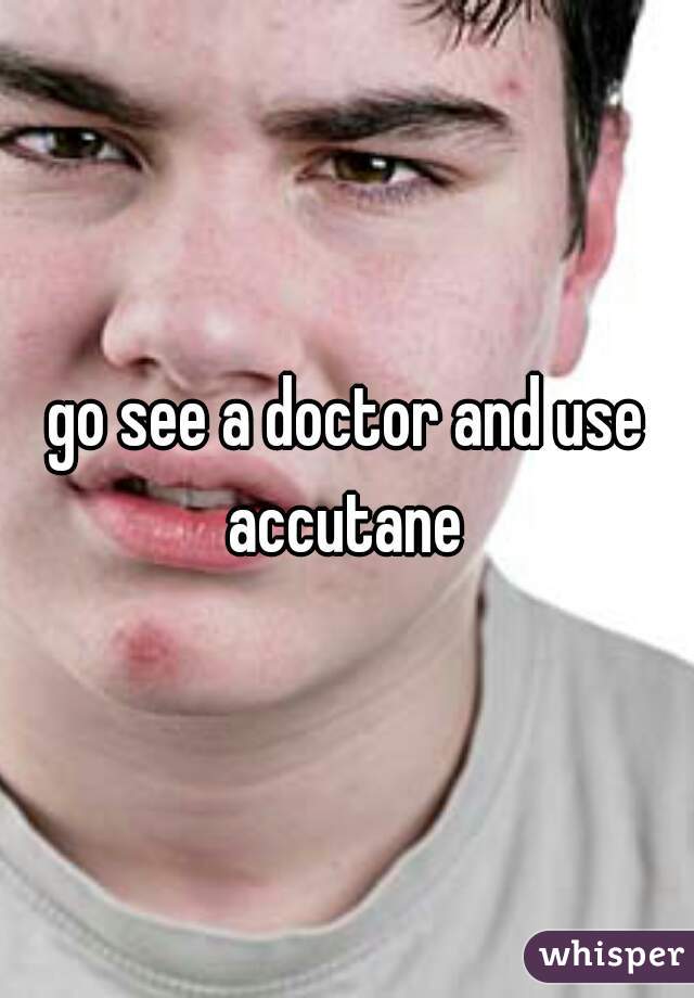 go see a doctor and use accutane 