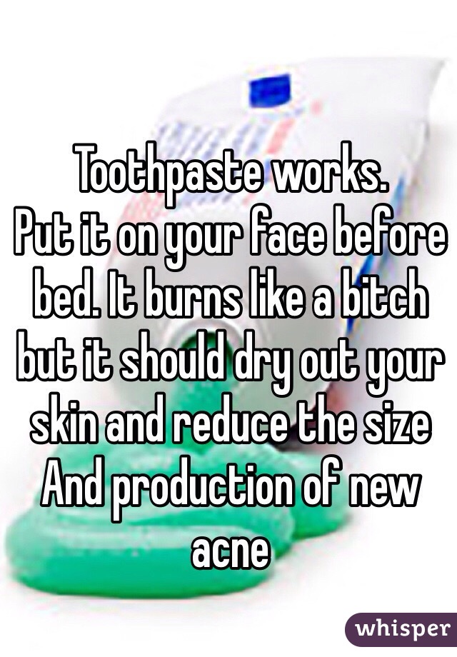 Toothpaste works. 
Put it on your face before bed. It burns like a bitch but it should dry out your skin and reduce the size And production of new acne
