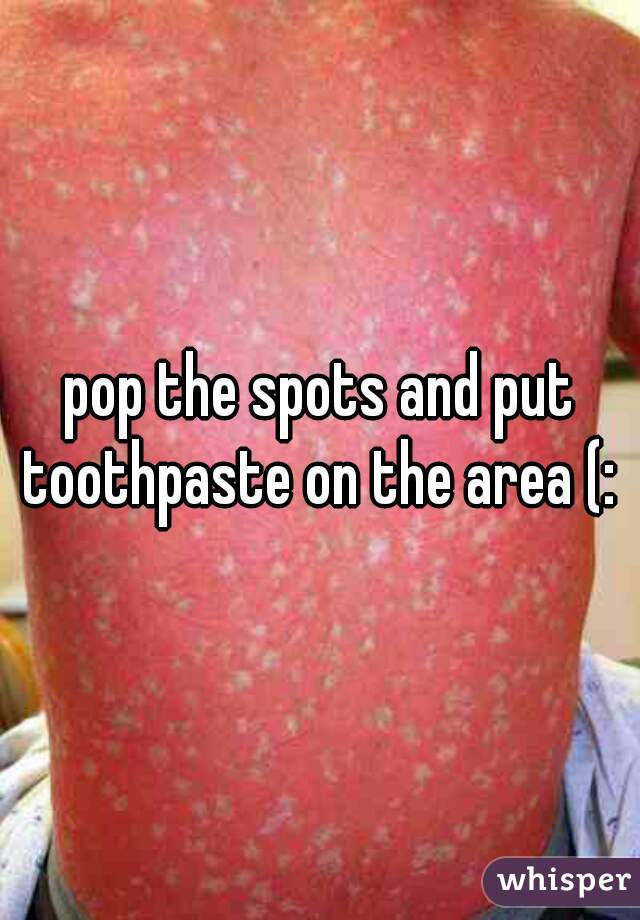 pop the spots and put toothpaste on the area (: 