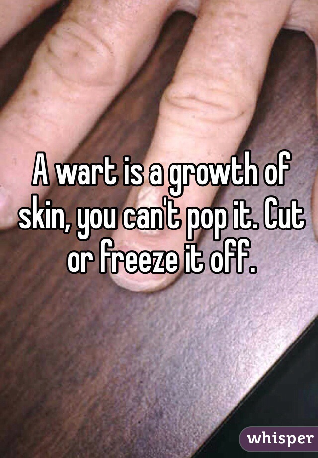 A wart is a growth of skin, you can't pop it. Cut or freeze it off.