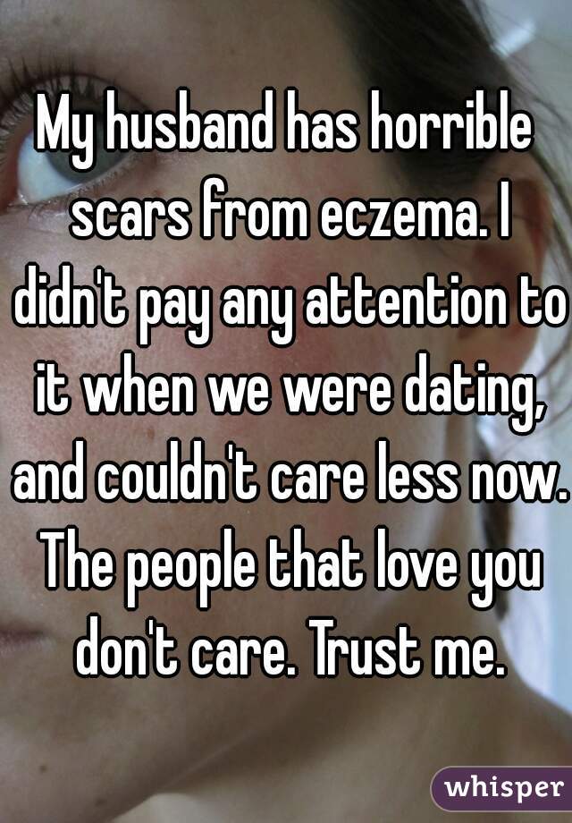 My husband has horrible scars from eczema. I didn't pay any attention to it when we were dating, and couldn't care less now. The people that love you don't care. Trust me.