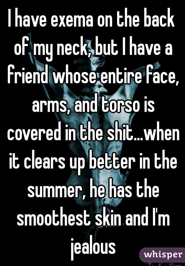 I have exema on the back of my neck, but I have a friend whose entire face, arms, and torso is covered in the shit...when it clears up better in the summer, he has the smoothest skin and I'm jealous