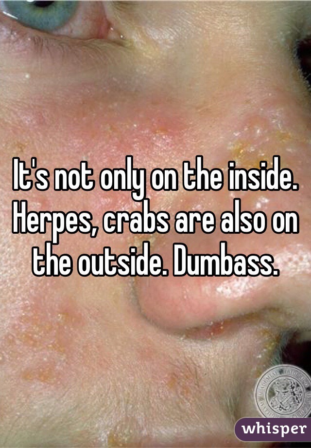 It's not only on the inside. Herpes, crabs are also on the outside. Dumbass.