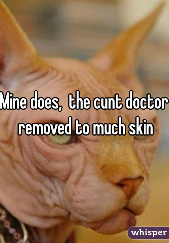 Mine does,  the cunt doctor removed to much skin