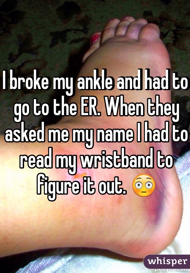 I broke my ankle and had to go to the ER. When they asked me my name I had to read my wristband to figure it out. 😳