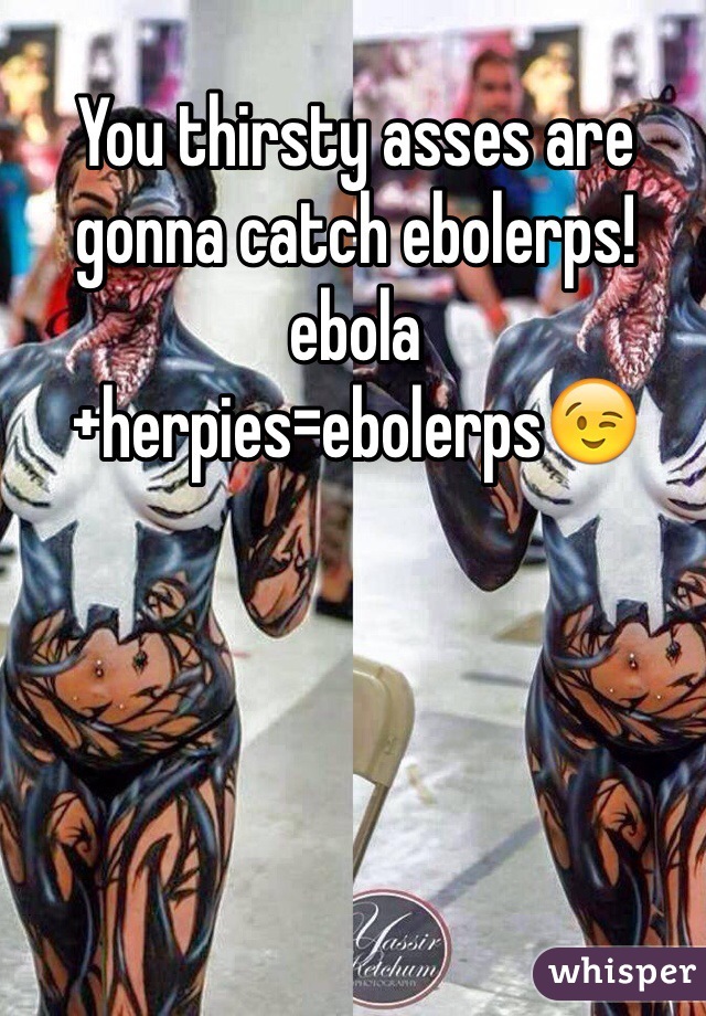 You thirsty asses are gonna catch ebolerps!
ebola+herpies=ebolerps😉