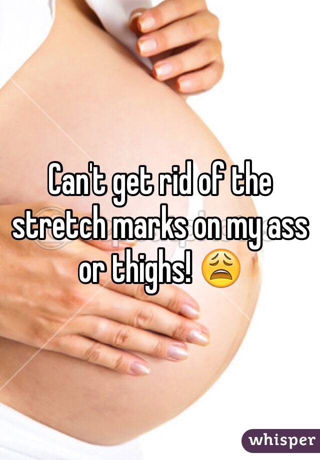 Can't get rid of the stretch marks on my ass or thighs! 😩