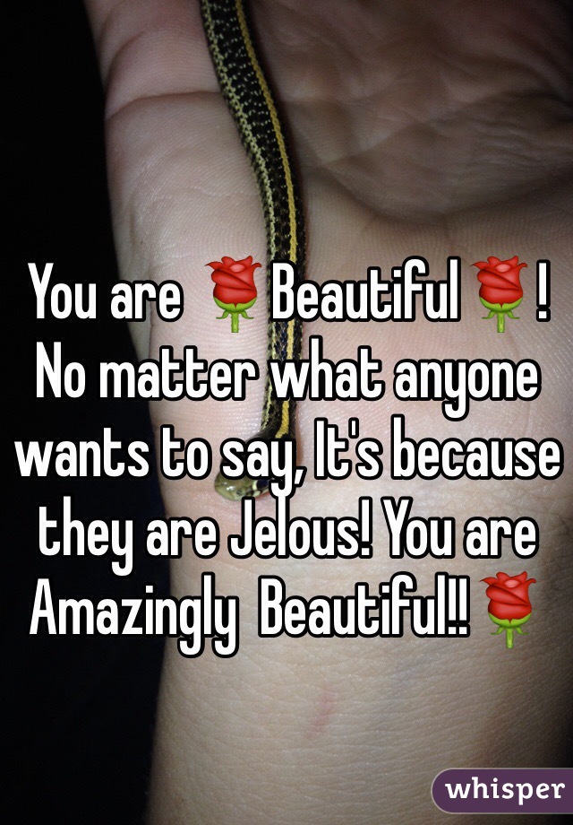 You are 🌹Beautiful🌹! No matter what anyone wants to say, It's because they are Jelous! You are Amazingly  Beautiful!!🌹