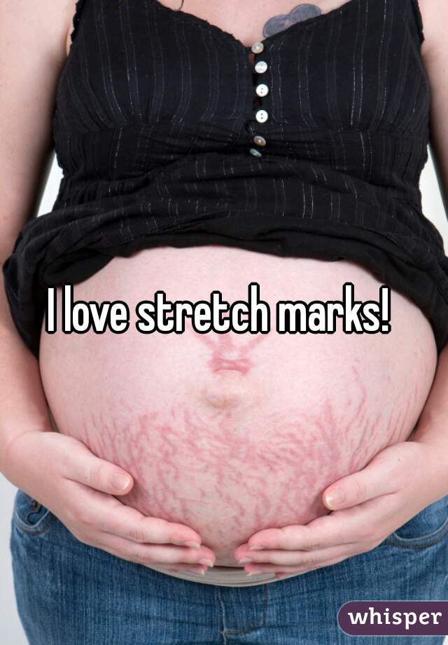 I love stretch marks! 