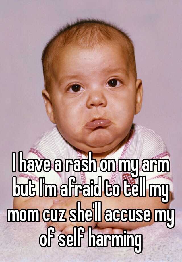 i-have-a-rash-on-my-arm-but-i-m-afraid-to-tell-my-mom-cuz-she-ll-accuse