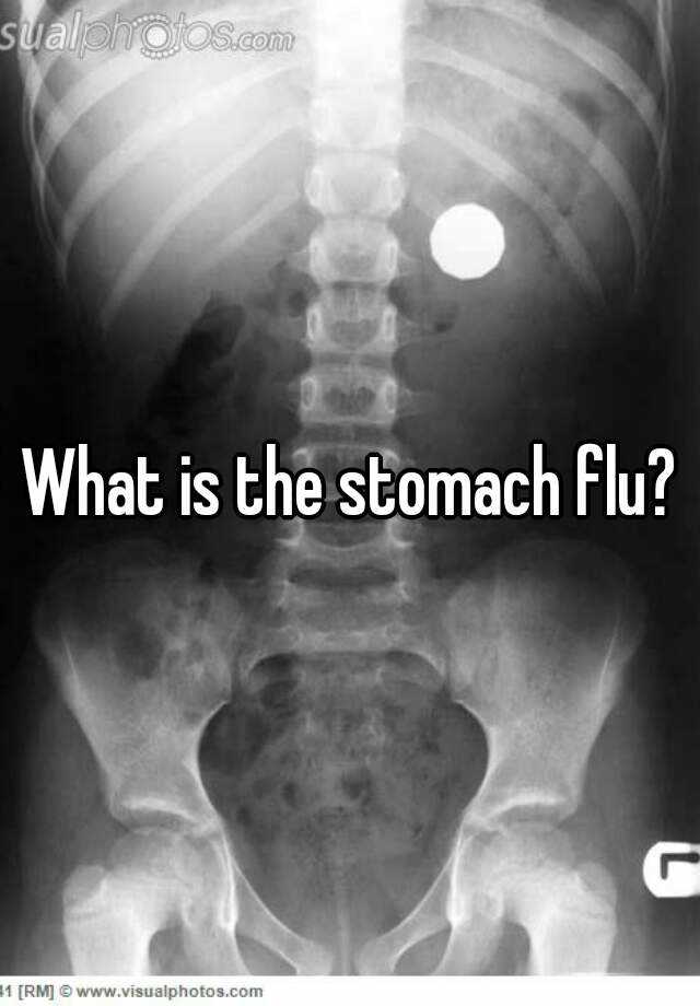 What is the stomach flu?