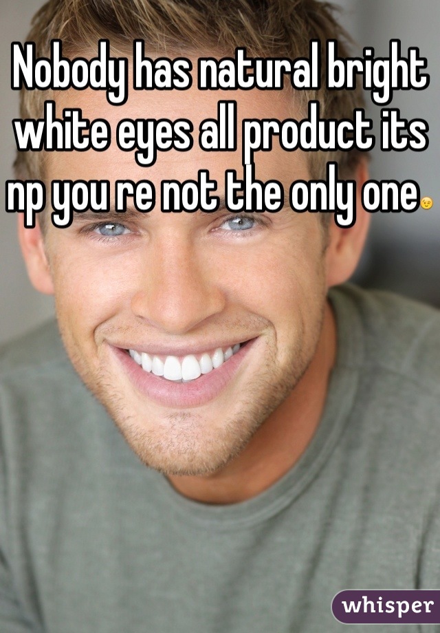 Nobody has natural bright white eyes all product its np you re not the only one😉