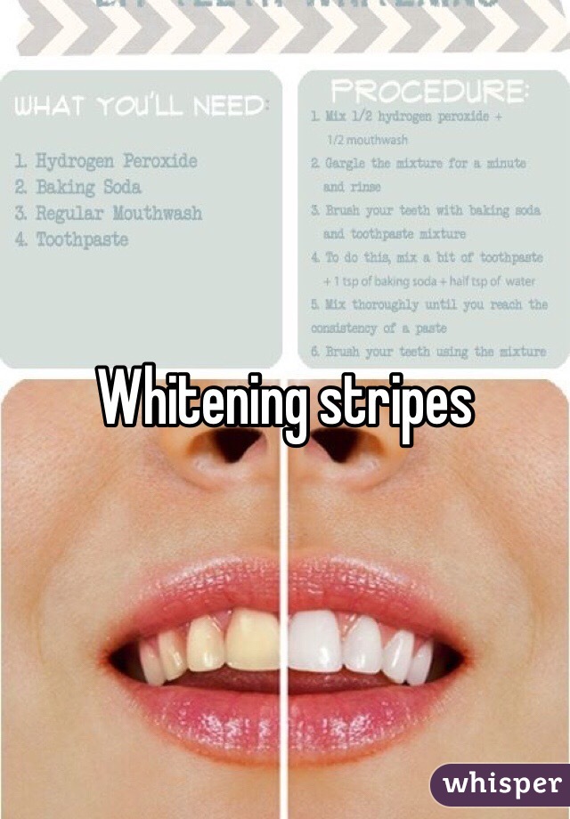 Whitening stripes 