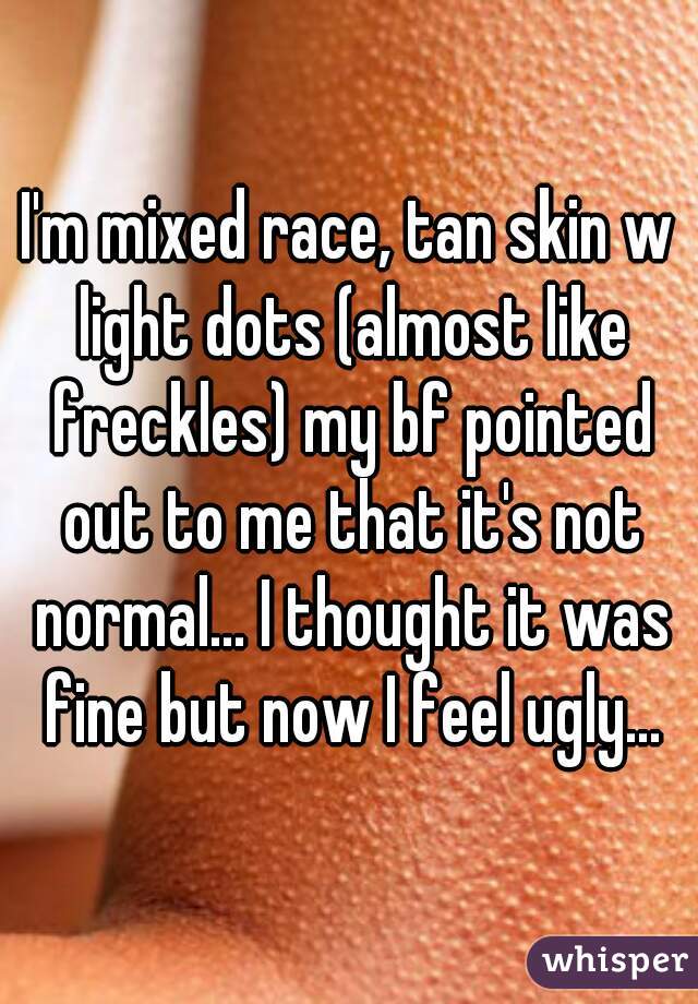 I'm mixed race, tan skin w light dots (almost like freckles) my bf pointed out to me that it's not normal... I thought it was fine but now I feel ugly...