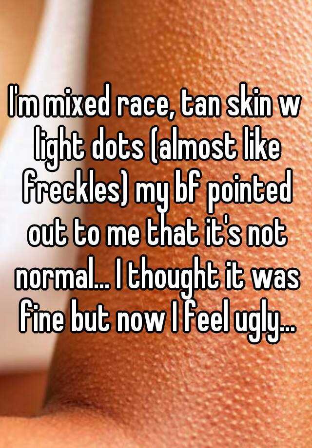 I'm mixed race, tan skin w light dots (almost like freckles) my bf pointed out to me that it's not normal... I thought it was fine but now I feel ugly...