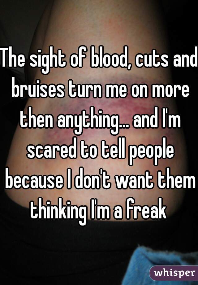 The sight of blood, cuts and bruises turn me on more then anything... and I'm scared to tell people because I don't want them thinking I'm a freak 
