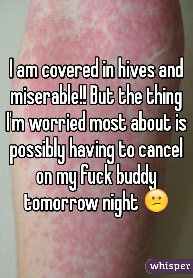 I am covered in hives and miserable!! But the thing I'm worried most about is possibly having to cancel on my fuck buddy tomorrow night 😕