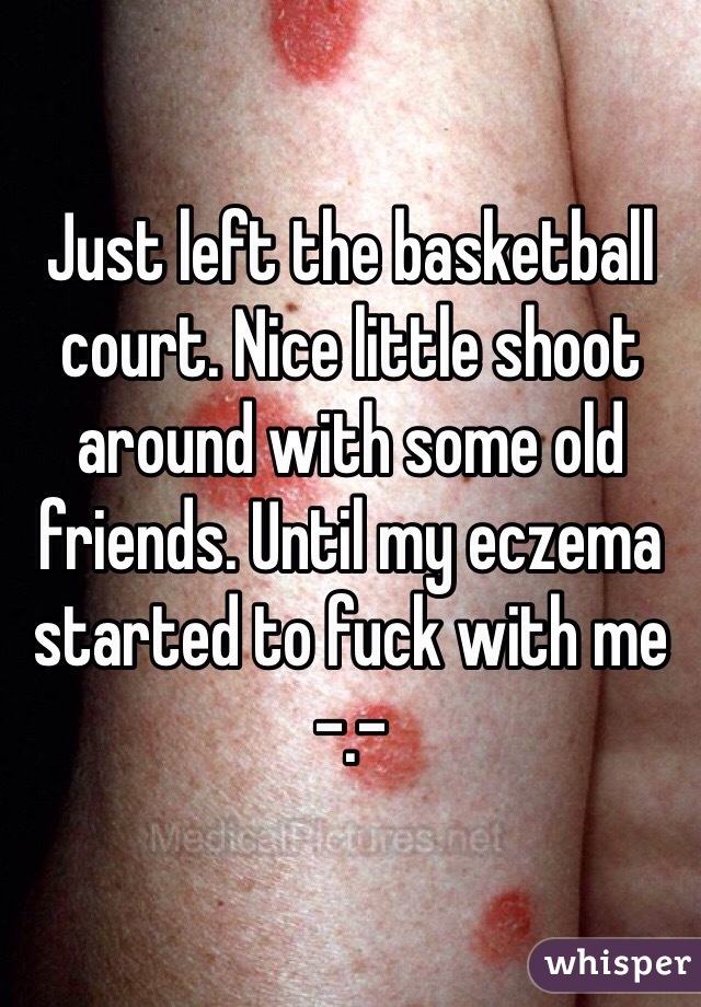 Just left the basketball court. Nice little shoot around with some old friends. Until my eczema started to fuck with me -.-