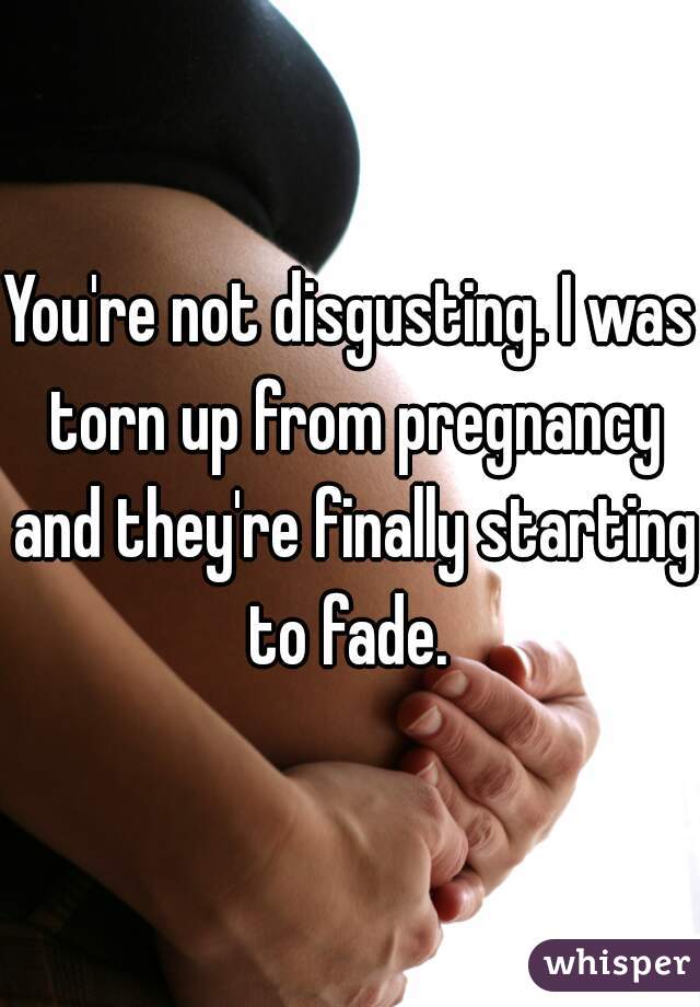 You're not disgusting. I was torn up from pregnancy and they're finally starting to fade. 