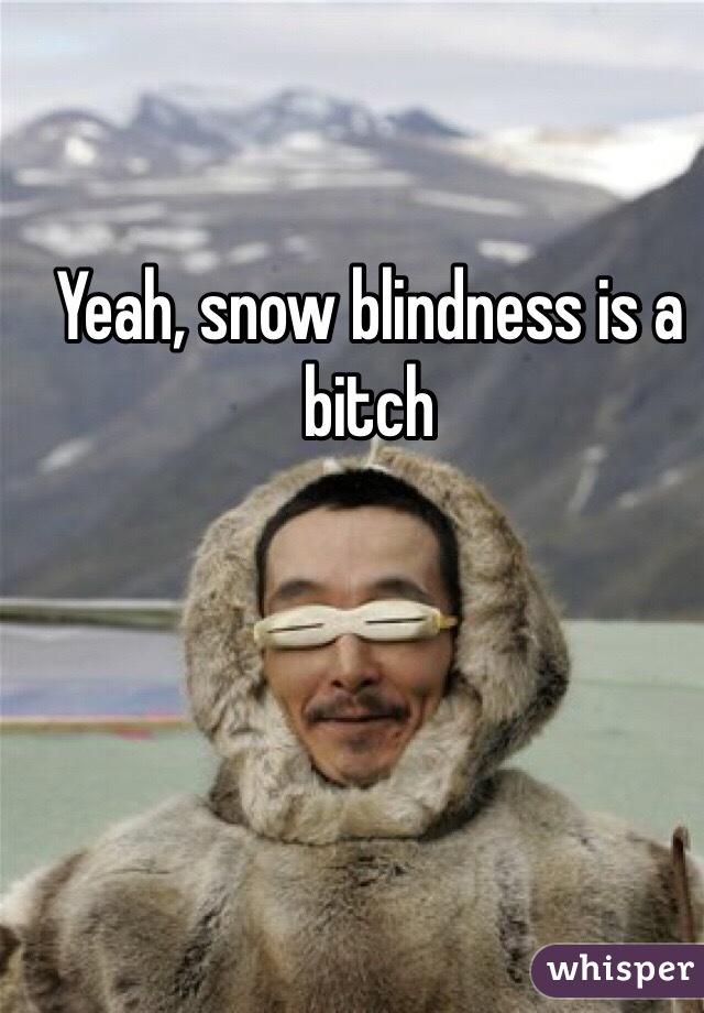 Yeah, snow blindness is a bitch