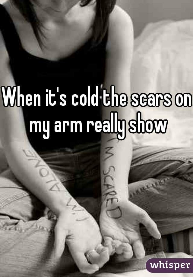 When it's cold the scars on my arm really show