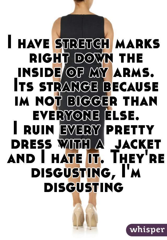 I have stretch marks right down the inside of my arms. Its strange because im not bigger than everyone else.
I ruin every pretty dress with a  jacket and I hate it. They're disgusting, I'm disgusting 