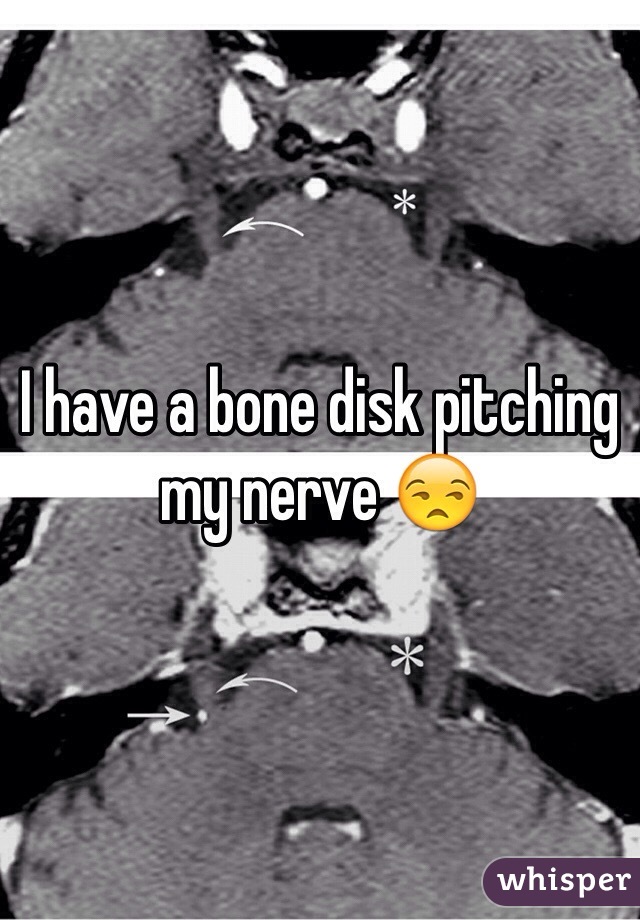 I have a bone disk pitching my nerve 😒 
