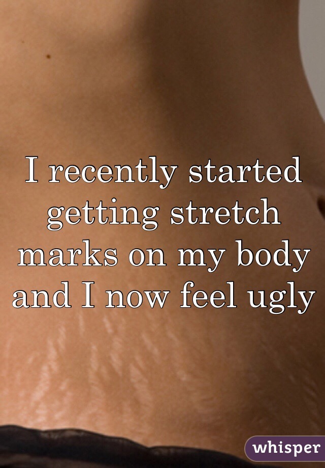 I recently started getting stretch marks on my body and I now feel ugly 