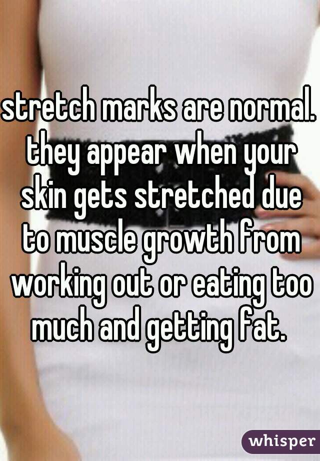 stretch marks are normal. they appear when your skin gets stretched due to muscle growth from working out or eating too much and getting fat. 