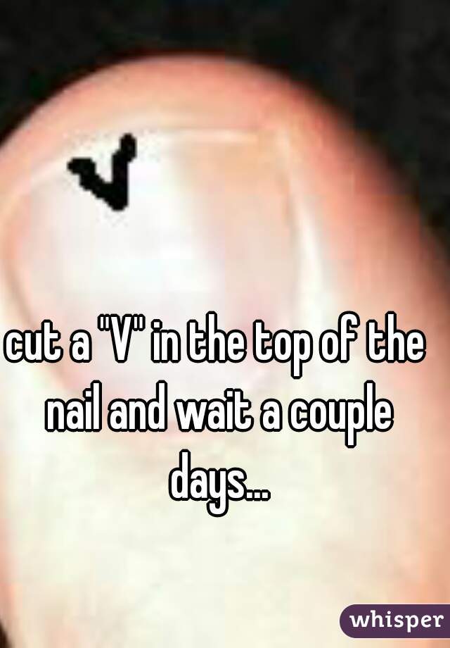 cut a "V" in the top of the nail and wait a couple days...