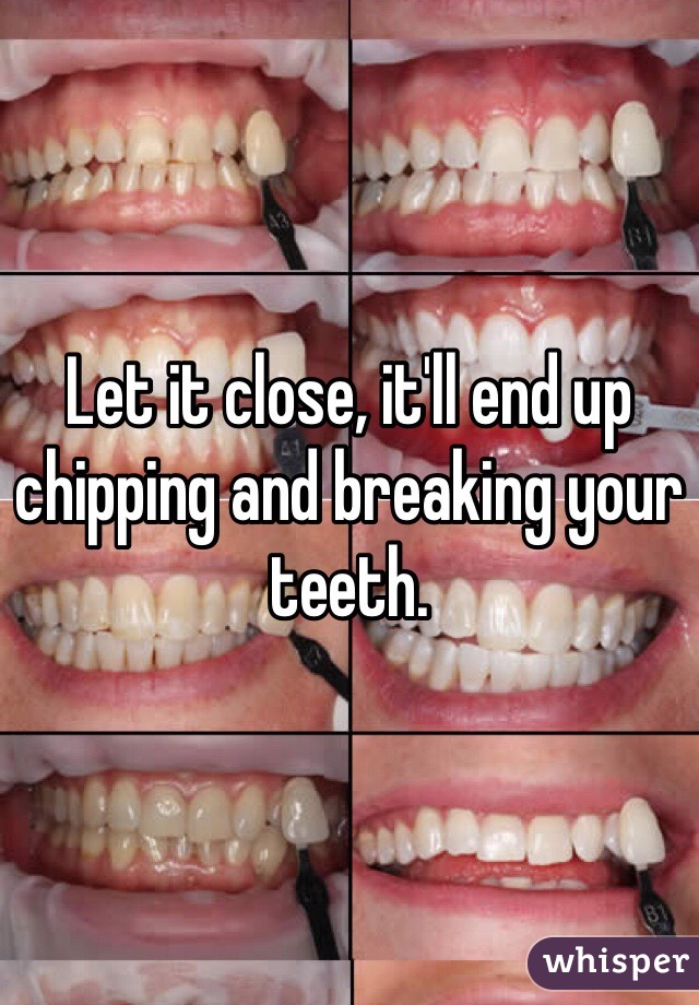 Let it close, it'll end up chipping and breaking your teeth.